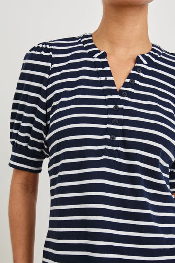 Jewel Puff Short Sleeve With Quarter Down Buttons In Colorway Navy Ivory Stripe - close up of details on model